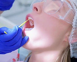 Patient receiving fluoride